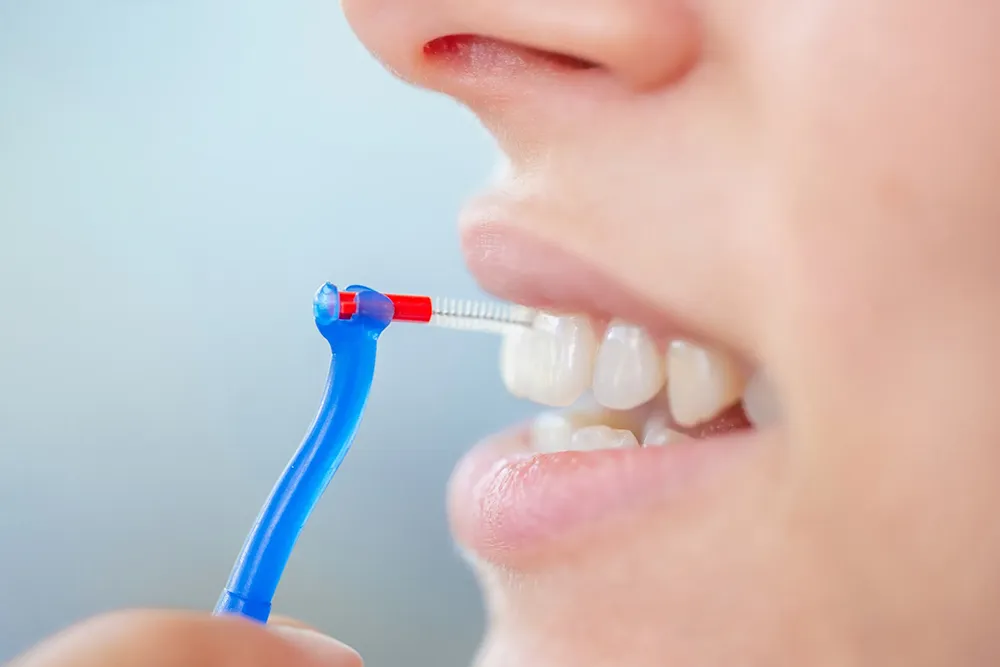 An Bealach Ceart chun Scuab Interdental a Úsáid